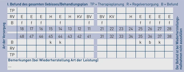 AAZ_Grafik_1. Beidseitige Freiendsituation und zwei fehlende Frontzähne_Schreiber.eps (Bild: Schreiber / IWW) AAZ_Grafik_1. Beidseitige Freiendsituation und zwei fehlende Frontzähne_Schreiber.eps (Bild: Schreiber / IWW)