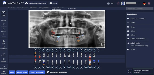 ZR-02.2022_Seite 10_Bild 2 mit Detektionen.eps (Bild: © Prof. F. Schwendicke) ZR-02.2022_Seite 10_Bild 2 mit Detektionen.eps (Bild: © Prof. F. Schwendicke)