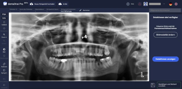 ZR-02.2022_Seite 10_Bild 1 ohne Detektionen.eps (Bild: © Prof. F. Schwendicke) ZR-02.2022_Seite 10_Bild 1 ohne Detektionen.eps (Bild: © Prof. F. Schwendicke)
