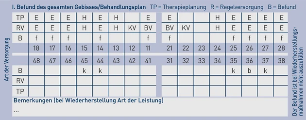 AAZ_Grafik_2. Beidseitige Freiendsituation und vier fehlende Frontzähne_Schreiber.eps (Bild: Schreiber / IWW) AAZ_Grafik_2. Beidseitige Freiendsituation und vier fehlende Frontzähne_Schreiber.eps (Bild: Schreiber / IWW)