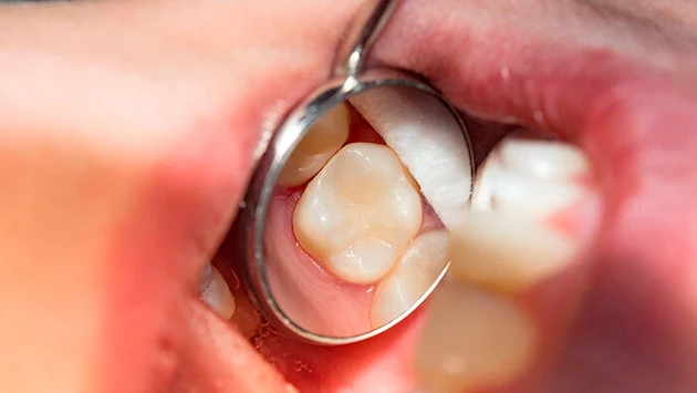 AdobeStock_187063042.jpg (Bild: Сергей Кучугурный - stock.adobe.com) AdobeStock_187063042.jpg (Bild: Сергей Кучугурный - stock.adobe.com)